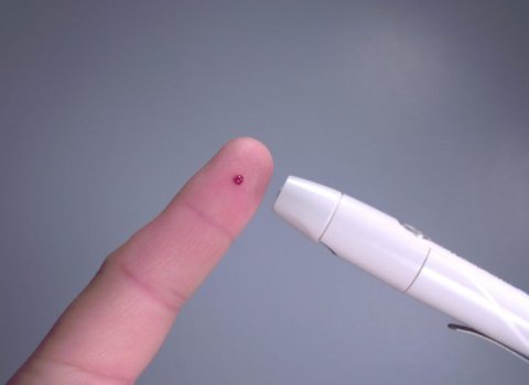 Irish-led project to treat diabetes with a cheek patch bags €3.8m from EU